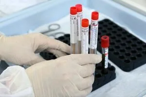 Число больных COVID-19 в Украине перевалило за 200: где нашли коронавирус