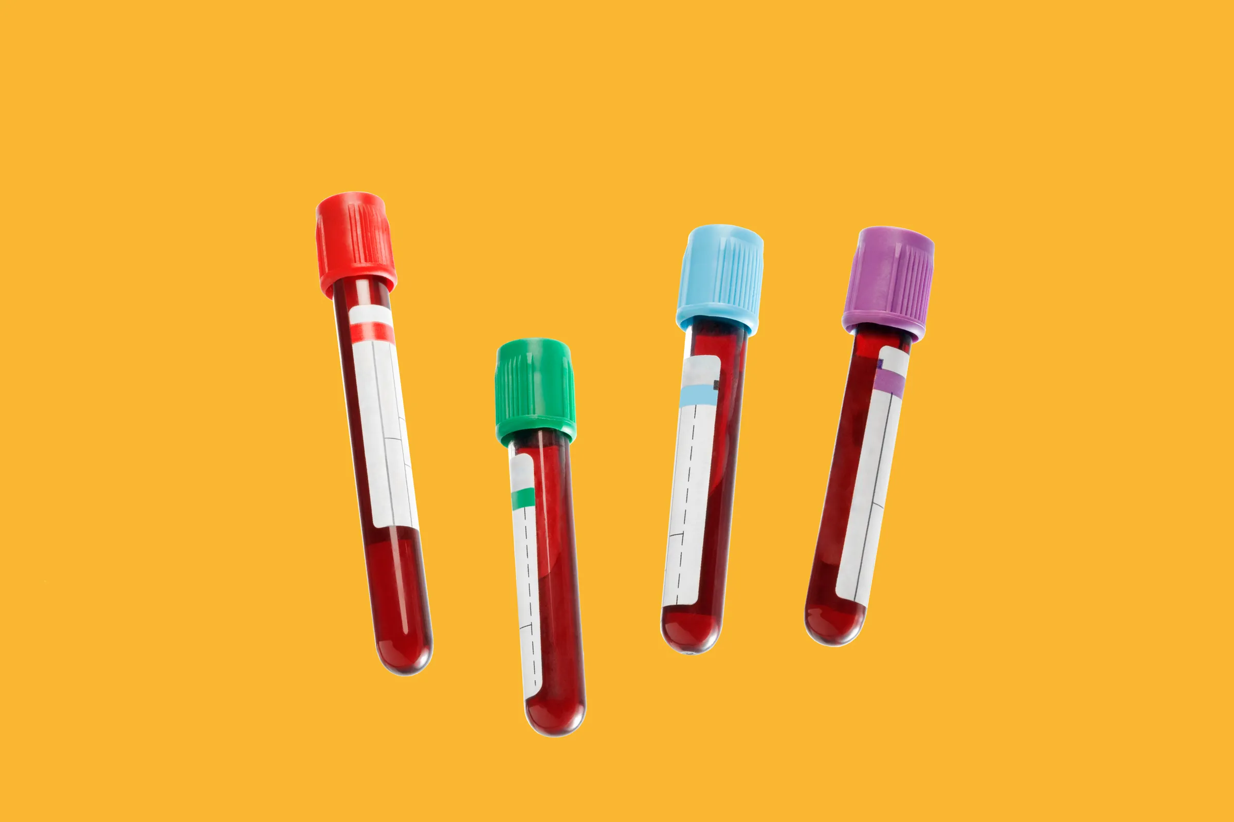 Причины гипергликемии и гипогликемии